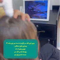 انالیز پوست و مو ۱۵ ایچ لیز