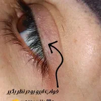 کاشت مژه ، اکستنشن و لیفت و لمینت مژه و ابرو