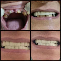 دندانپزشکی/ترمیم/کامپوزیت/لمینیت/عصبکشی قسطی|خدمات آرایشگری و زیبایی|مشهد, سجاد شهر|دیوار