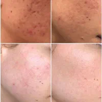 محصولات آرایشی و بهداشتی و درمانی وکرم های ضدلک|آرایشی، بهداشتی، درمانی|شیراز, گویم|دیوار