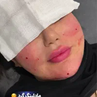 خدمات ژل عربی خلیجی زیبادرکلینیک