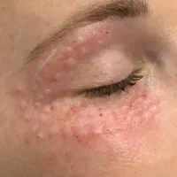 مرکز تخصصی فیلر بادی (فرم دهی بدن و زیبایی اندام)|خدمات آرایشگری و زیبایی|تهران, تهرانسر شرقی|دیوار