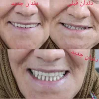 ساخت و تعمیر دندان متحرک|خدمات آرایشگری و زیبایی|شیراز, دکتر حسابی|دیوار