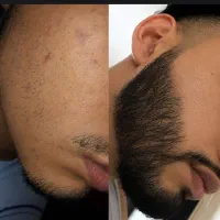 این آخرین روشیه که امتحان میکنی
