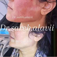 جشنواره تمامی تزریقات زیبایی در مطب پزشک