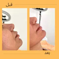 خدمات زیبایی در کلینیک ماهورا|خدمات آرایشگری و زیبایی|بندرعباس, |دیوار