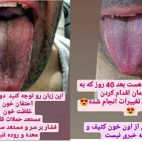 تشخیص بیماریها از روی زبان و درمان|خدمات آرایشگری و زیبایی|جیرفت, |دیوار