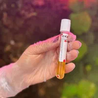 جشنواره تخفیف پی آر پی(PRP)/مزونیدلینگ مو و صورت|خدمات آرایشگری و زیبایی|اصفهان, باغ زرشک|دیوار