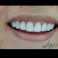 دندانپزشکی با بیمه تکمیلی و آزاد / بدون پیش|خدمات آرایشگری و زیبایی|بهبهان, |دیوار