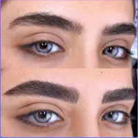 خدمات مدل میکروبلیدینگ فیبروز خطچشم آموزش توسطمربی