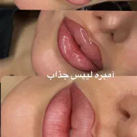 فقط هزینه مواد