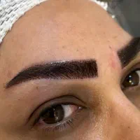 کاشت ابرو فول تراکم/طبیعی/تضمینی/