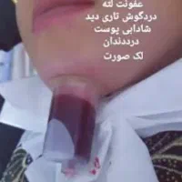 کار طب سنتی با آموزش ودرآمد در منزل|استخدام درمانی، زیبایی، بهداشتی|قرچک, زیبا شهر|دیوار