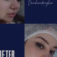 انجام انواع جراحی زیبایی باشرایط اقساط