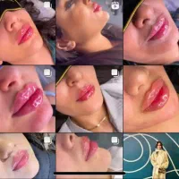 تغییرات زیبایی شگفت انگیز برای شما