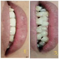 ترمیم و زیبایی