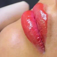 تزریق ژل و بوتاکس با بروزترین تکنیک ها|خدمات آرایشگری و زیبایی|ارومیه, |دیوار