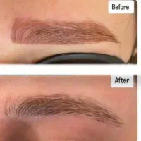 پاک کردن انواع تتو و خالکوبی بالیزر تخصصی کیوسویچ|خدمات آرایشگری و زیبایی|فولادشهر, پارک کوهستان|دیوار