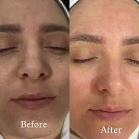 فشیال تخصصی آقایان و خانم ها