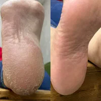 آموزش تخصصی پدیکور برای ورود به بازار