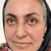 کرم معجزه اصلی دستساز متخصص تهران|آرایشی، بهداشتی، درمانی|کوهدشت, |دیوار