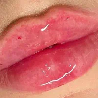 مطب زیبایی پردیس
