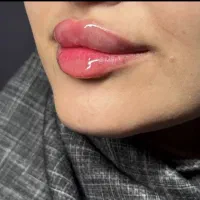 کلینیک زیبایی بوتاکس ، ژل ، فیلر