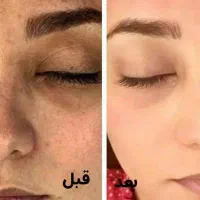کرم لک