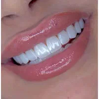 تخفیف ویژه کامپوزت سرامیکی لبه شفاف
