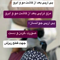 پی آر پی مو و صورت تخفیف ویژه پی ارپی بعدازکاشت مو|خدمات آرایشگری و زیبایی|قزوین, |دیوار