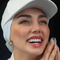 دندان کامپوزیت دندانپزشکی|خدمات آرایشگری و زیبایی|مشهد, دانشجو|دیوار
