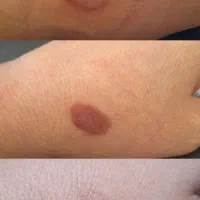 صابون های درمانی دستساز تیارا|آرایشی، بهداشتی، درمانی|شاهین‌شهر, فدک|دیوار