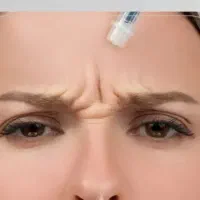 مدل برای بوتاکس|خدمات آرایشگری و زیبایی|اهواز, رسالت|دیوار