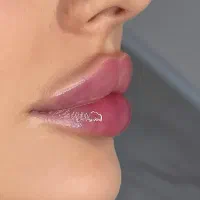 ژل بوتاکس فیلر زاویه سازی خط لبخند لیزر مطب پزشک|خدمات آرایشگری و زیبایی|قم, ارم|دیوار