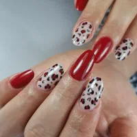 آفر کاشت وترمیم حرفهای