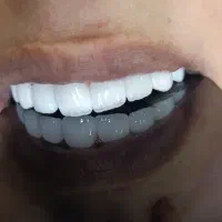 دندانپزشکی بیمه تامین اجتماعی کمیته امدادوبهزیستی|خدمات آرایشگری و زیبایی|نورآباد, |دیوار