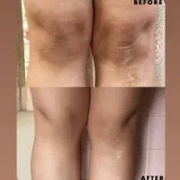 بلک فرایدی وایتنینگ تخصصی بیکینی زیربغل زانو|خدمات آرایشگری و زیبایی|رشت, رودباری|دیوار