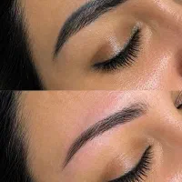 حذف تتو ابرو بدن ،کربن تراپی، رد بخیه با کیوسوییچ