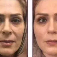 کرم اکسیر جوانی با روغن کاملا طبیعی