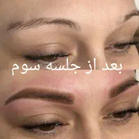 لیزر پاک کردن تتو بشکل مدرن|خدمات آرایشگری و زیبایی|اهواز, فرهنگ شهر|دیوار