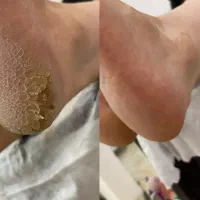کاشت ناخن|خدمات آرایشگری و زیبایی|محلات, |دیوار