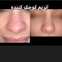 انزیم بینی|خدمات آرایشگری و زیبایی|الشتر, |دیوار