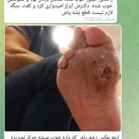 اگه قند داری چربی داری کلی مشکلات بیا