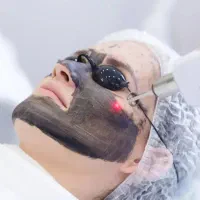 کربن تراپی فیشیال وایتنینگ پاک کردن تتو تیرگی چشم