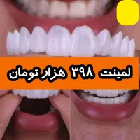 سفید و براق  و شیک GEPL