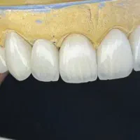 دندانپزشکی نعمت آباد عبدل اباد خلازیل|خدمات زیبایی و سلامت|تهران, شهرک ابوذر|دیوار