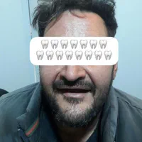 دندانسازی رستمی|خدمات آرایشگری و زیبایی|زنجان, |دیوار