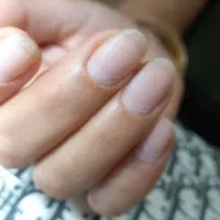 جذب ناخنکار