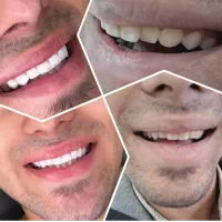 کامپوزیت فقط با ۸ میلیون و ۸۰۰ با ضمانت