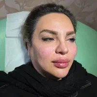 جشنواره کلینیک ژل و بوتاکس ۵۹۰|خدمات آرایشگری و زیبایی|اصفهان, خلجا|دیوار